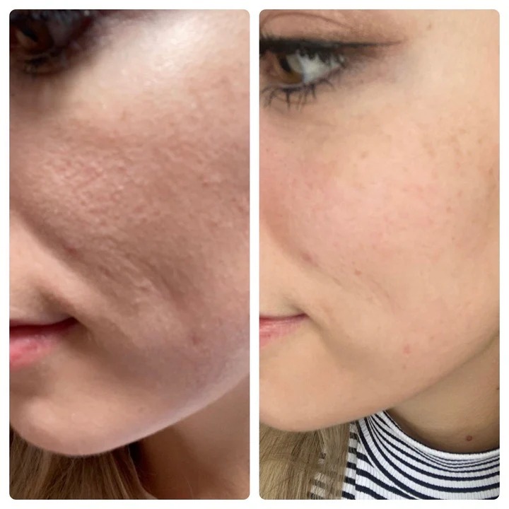 Karen B. testimonial